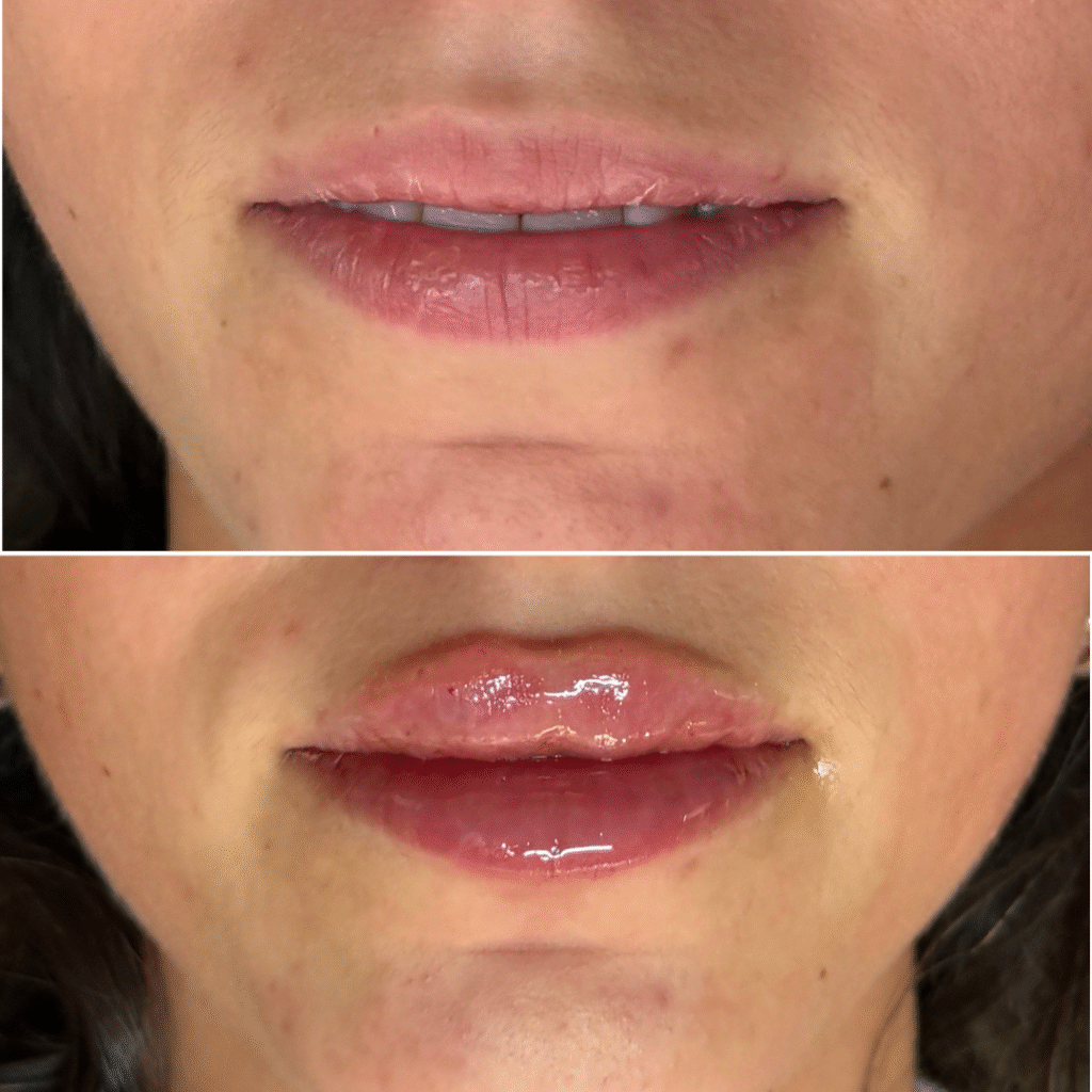 Petal Lips