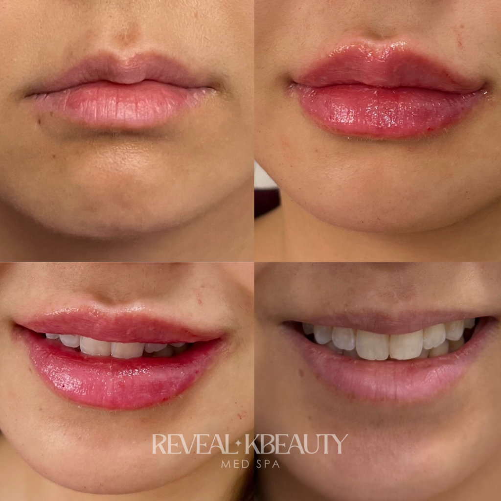 Signature Petal Lips