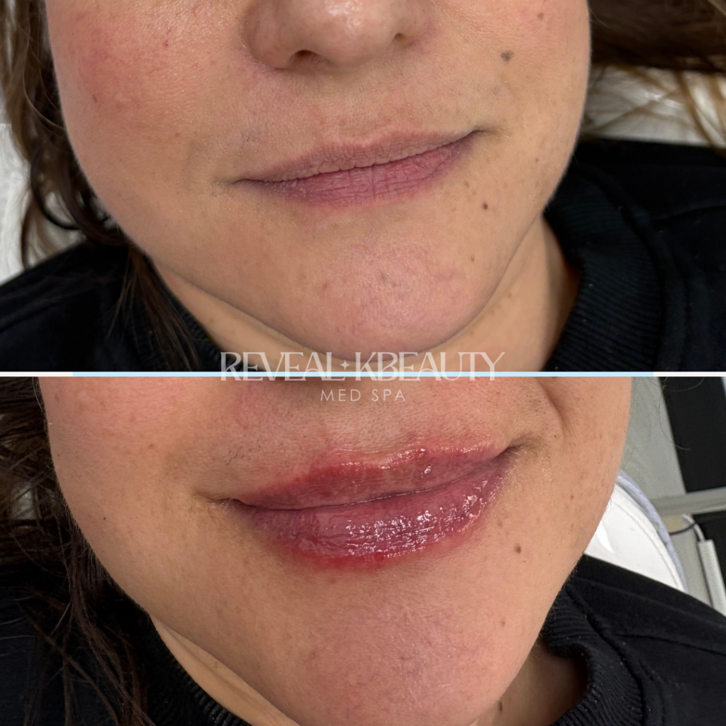 Signature Petal Lips