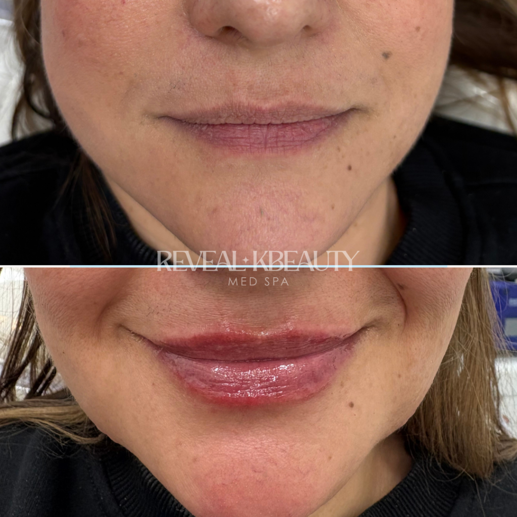 Signature Petal Lips