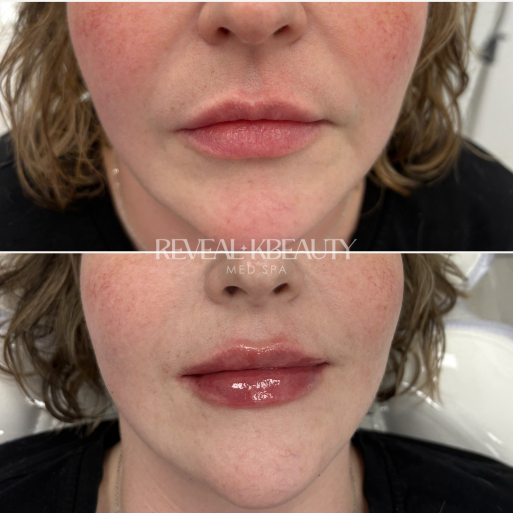 Signature Petal Lips