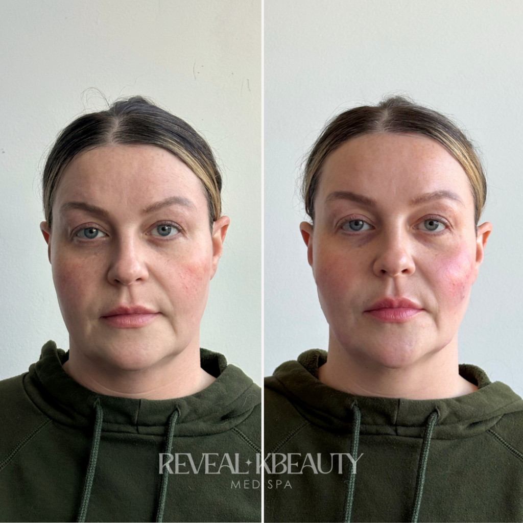 Signature reveal harmony lift